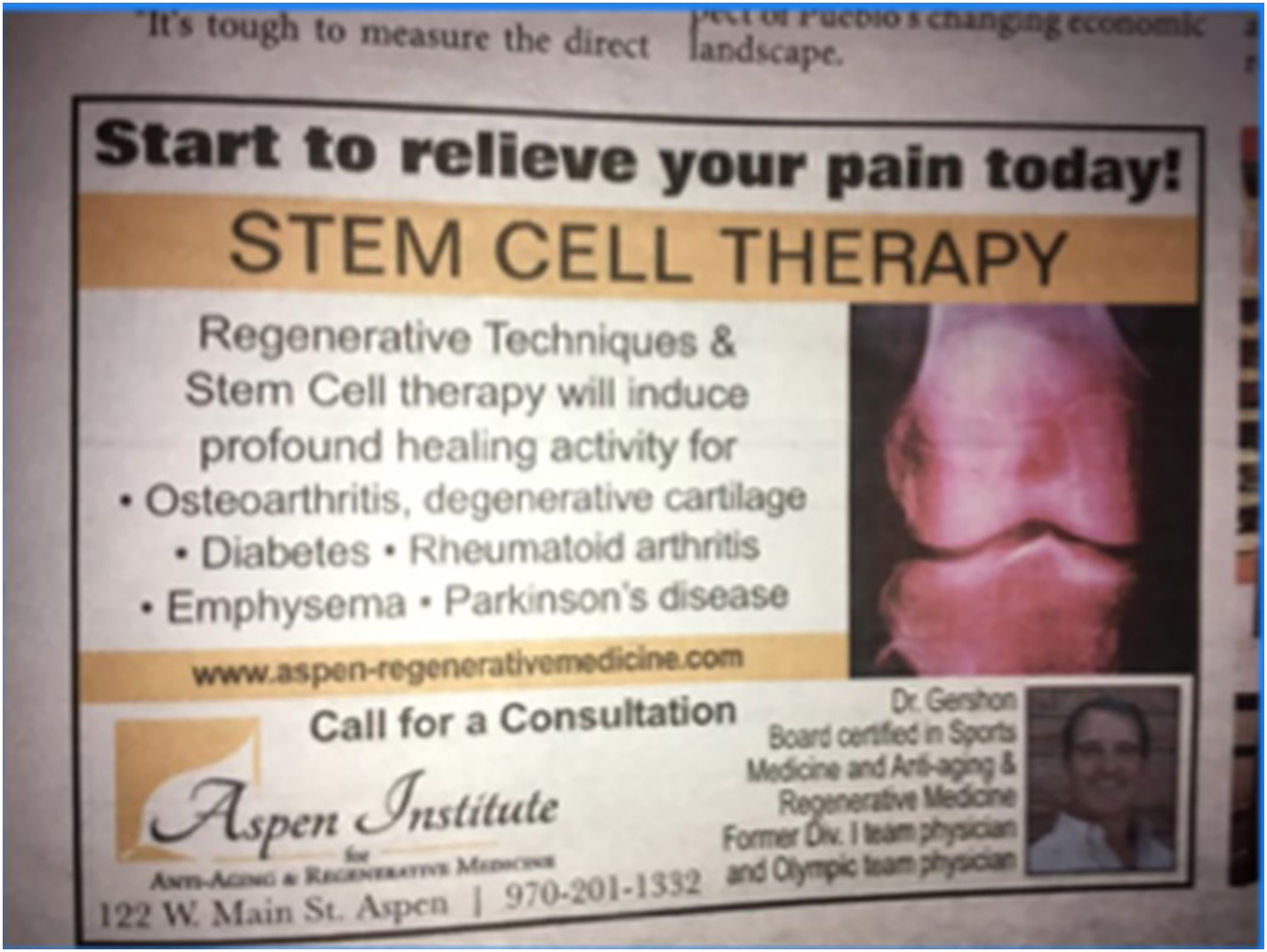 間充質干細胞治療1型糖尿病臨床應用案例 間充質干細胞治療1型糖尿病臨床應用案例