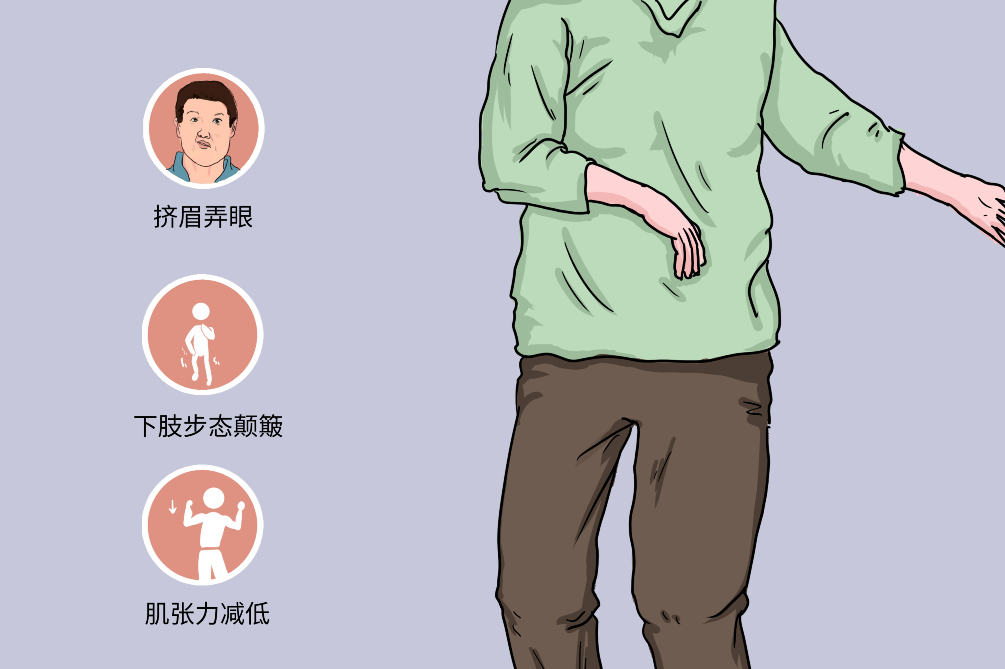 干細胞療法治療亨廷頓病的臨床前試驗進展 干細胞療法治療亨廷頓病的臨床前試驗進展