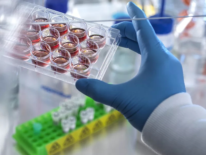 間充質(zhì)干細(xì)胞治療阿爾茨海默病的臨床前研究