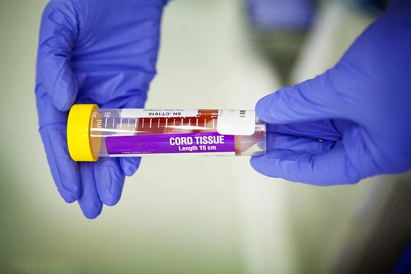 間充質(zhì)干細(xì)胞的優(yōu)點(diǎn)有哪些？