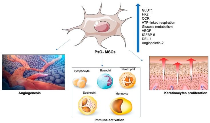 圖3:PsO-MSCs對銀屑病皮損血管形成的影響:
圖3:PsO-MSCs對銀屑病皮損血管形成的影響: