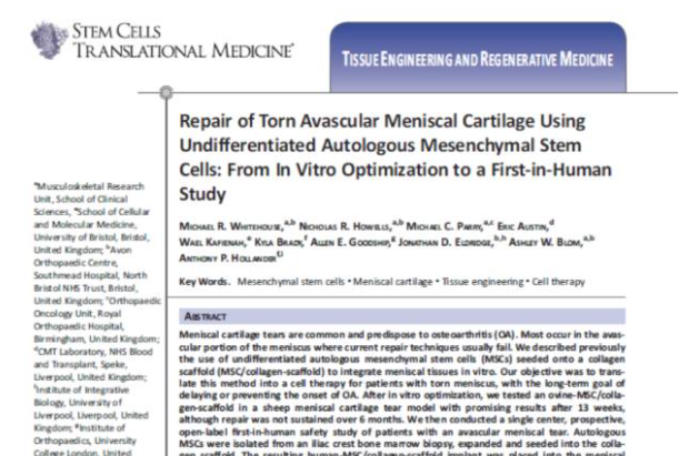 間充質(zhì)干細(xì)胞能夠幫助修復(fù)受損的半月板組織,不用手術(shù)切除受傷部位也能讓膝關(guān)節(jié)功能恢復(fù)正常。