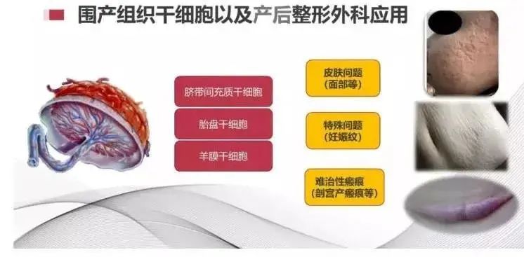 圍產組織細胞以及產后整形外科應用 圍產組織細胞以及產后整形外科應用