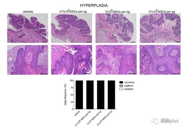 2?全身施用同種異體間充質干細胞不會增加腫瘤惡性程度