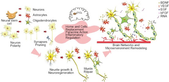 神經干細胞移植修復腦損傷的方案