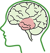 基底神經節損傷大