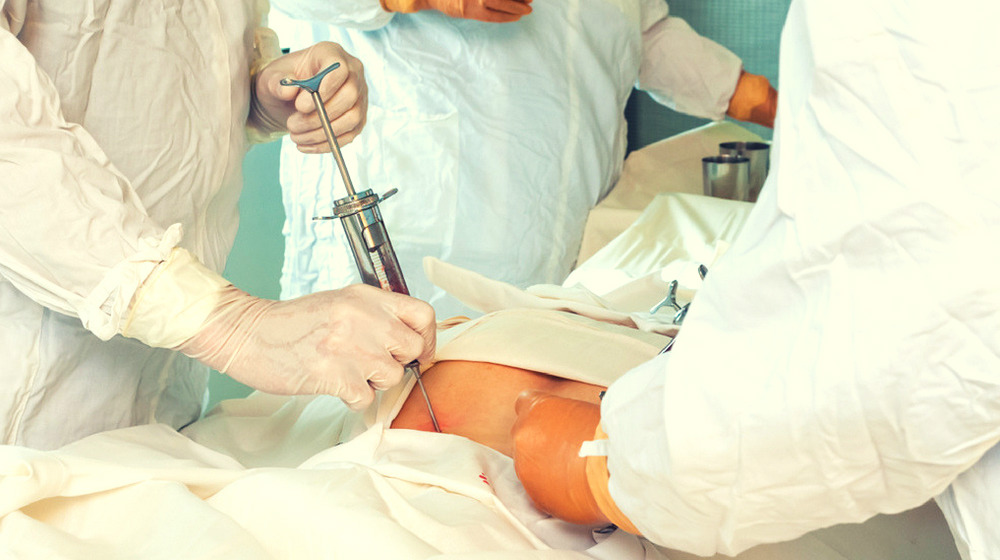 關(guān)于自體干細(xì)胞移植的須知 關(guān)于自體干細(xì)胞移植的須知