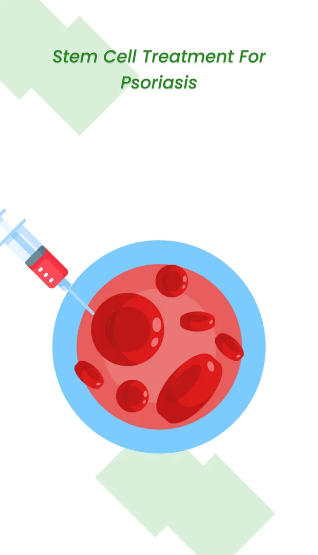 干細胞治療牛皮癬