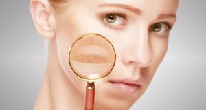 間充質干細胞治療系統性紅斑狼瘡