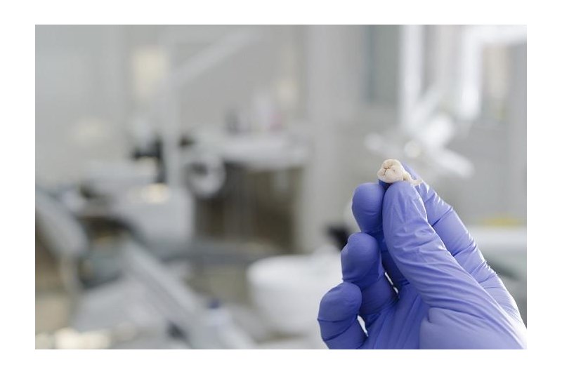 來自牙齒的干細胞可以幫助治療抑郁癥