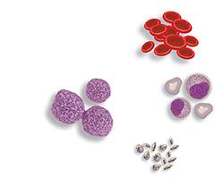 用于移植的干細胞可以來自骨髓或血液 用于移植的干細胞可以來自骨髓或血液