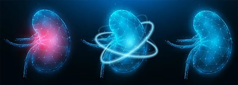 干細胞治療慢性腎病相對于腎移植的10個好處 干細胞治療慢性腎病相對于腎移植的10個好處