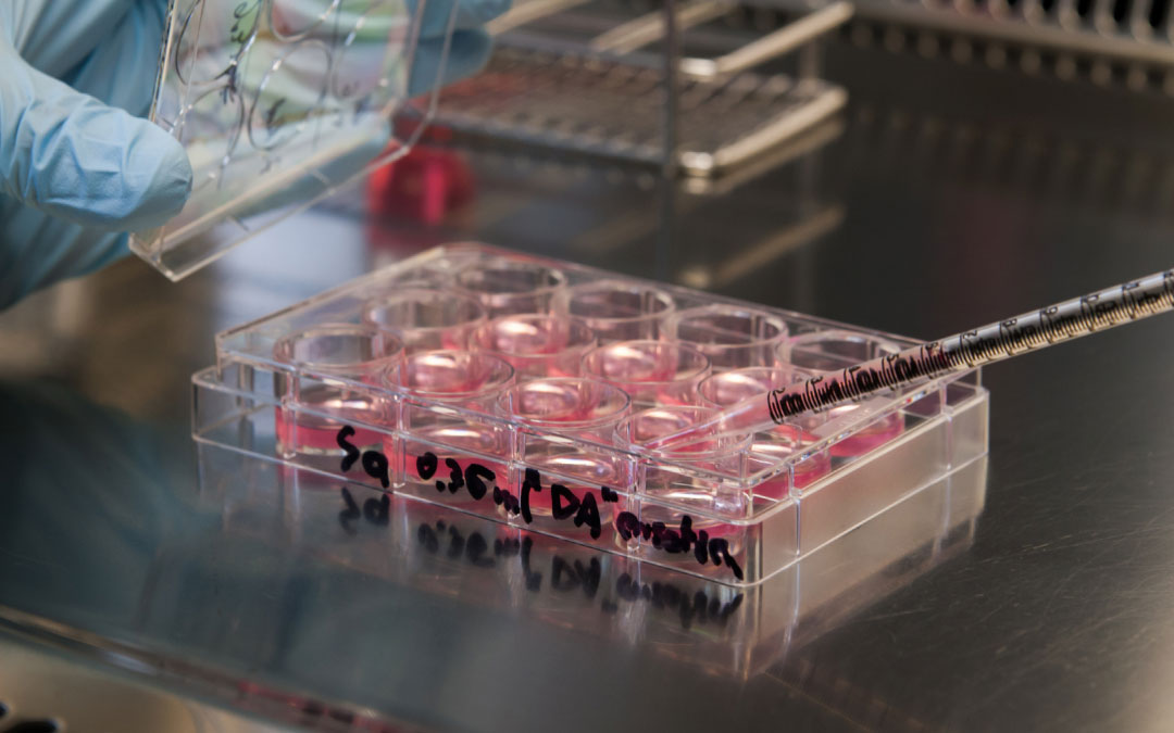 踝關(guān)節(jié)疼痛的干細(xì)胞療法 踝關(guān)節(jié)疼痛的干細(xì)胞療法