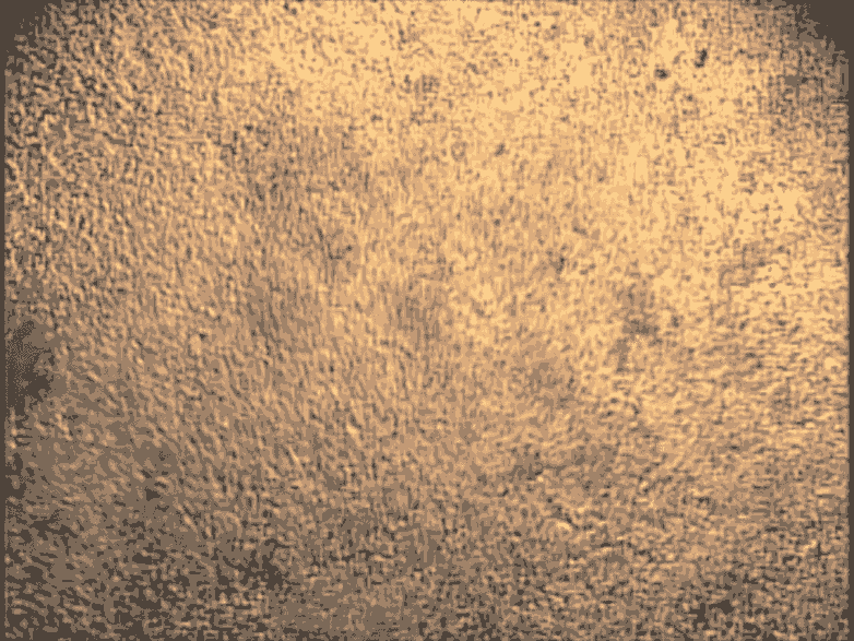 這些心臟細胞是從培養皿中的干細胞中培養出來的,可用于研究心臟的跳動節律。 這些心臟細胞是從培養皿中的干細胞中培養出來的,可用于研究心臟的跳動節律。