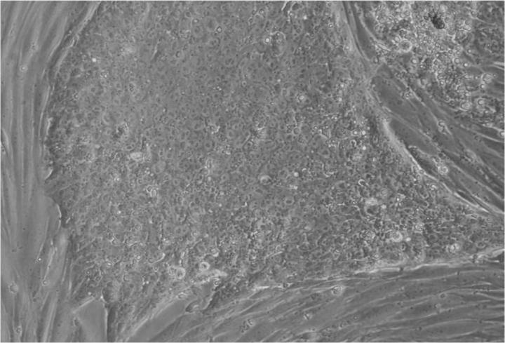 胚胎干細胞移植的來源