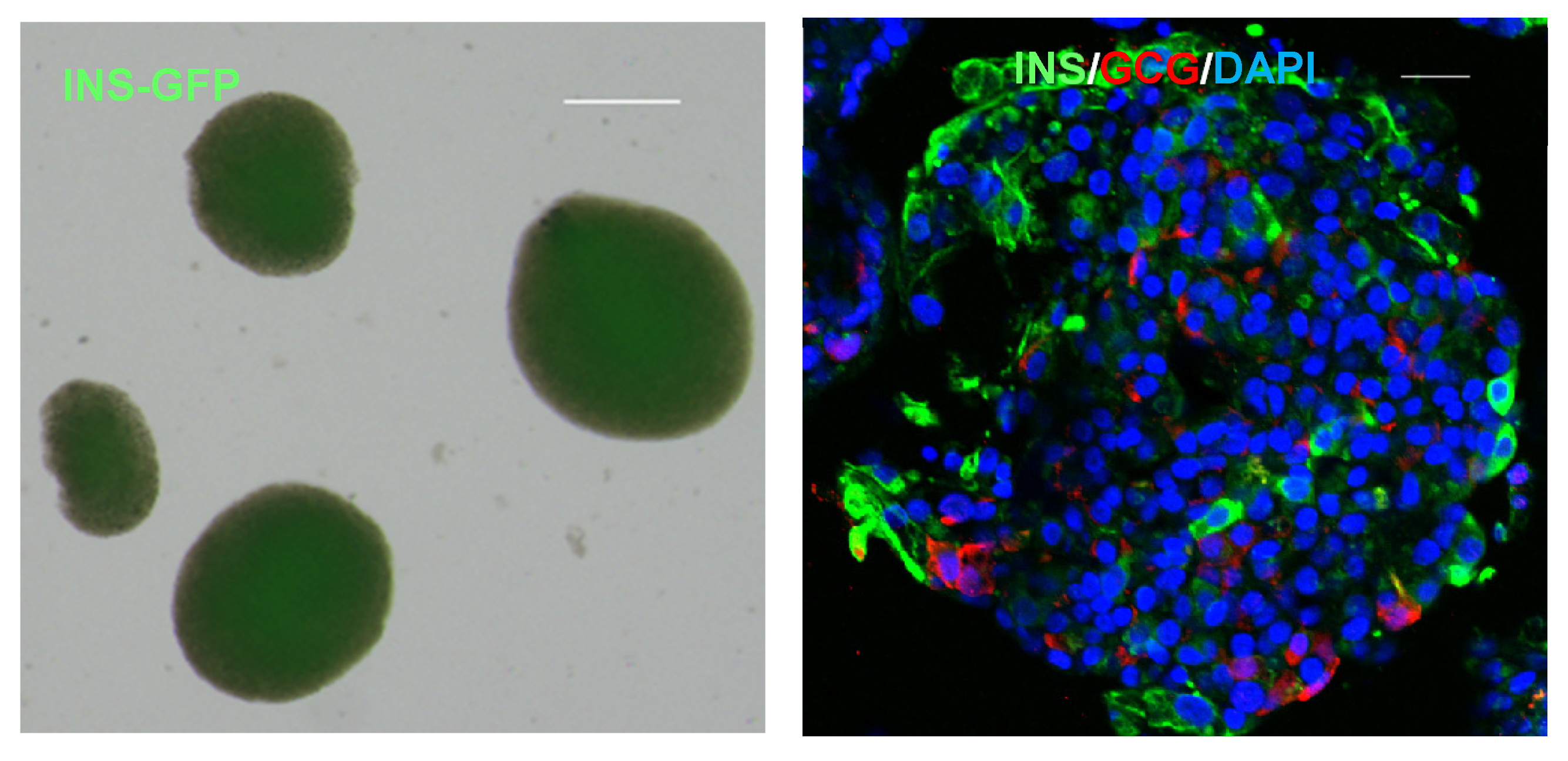 圖1顯示了人類多能干細胞 (hPSC) 衍生的胰島器官的圖像 圖1顯示了人類多能干細胞 (hPSC) 衍生的胰島器官的圖像