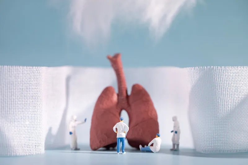 慢性阻塞性肺病（COPD）的四個階段