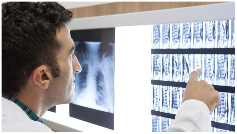 完全性脊髓損傷和不完全性脊髓損傷之間有什么區(qū)別? 完全性脊髓損傷和不完全性脊髓損傷之間有什么區(qū)別?