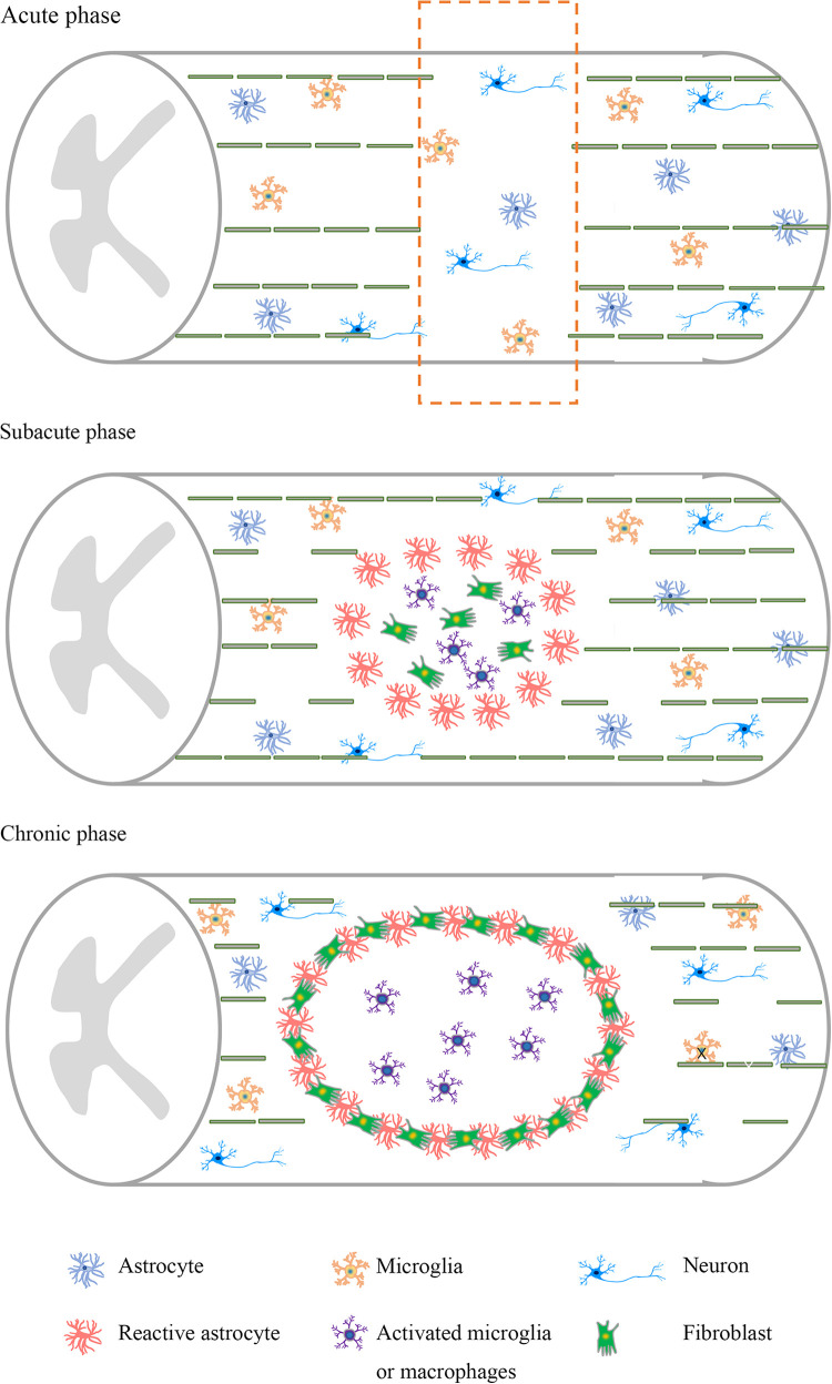 圖1：脊髓損傷不同階段的病理特點。