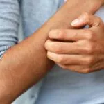 肝臟損傷的警告信號(hào),肝臟疾病的警告信號(hào) - 瘙癢 肝臟損傷的警告信號(hào),肝臟疾病的警告信號(hào) - 瘙癢