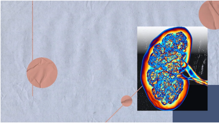 如何篩查糖尿病腎病-有哪些方法？