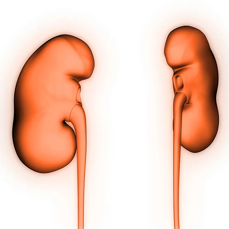 IgA腎?。喊Y狀-病因-診斷-飲食等