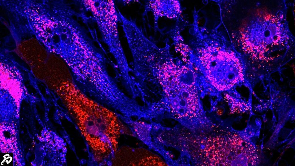干細胞治療:未來醫學的新星,2030年獲批數量或將突破25款 干細胞治療:未來醫學的新星,2030年獲批數量或將突破25款