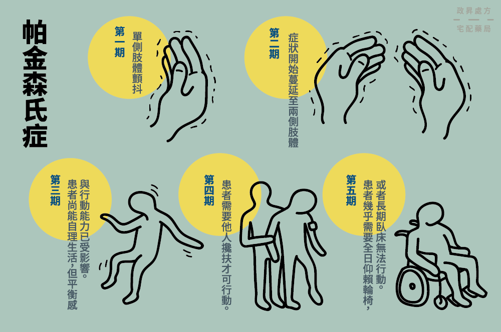 神經(jīng)干細胞移植管理帕金森病：挑戰(zhàn)、納米技術(shù)支持和前景