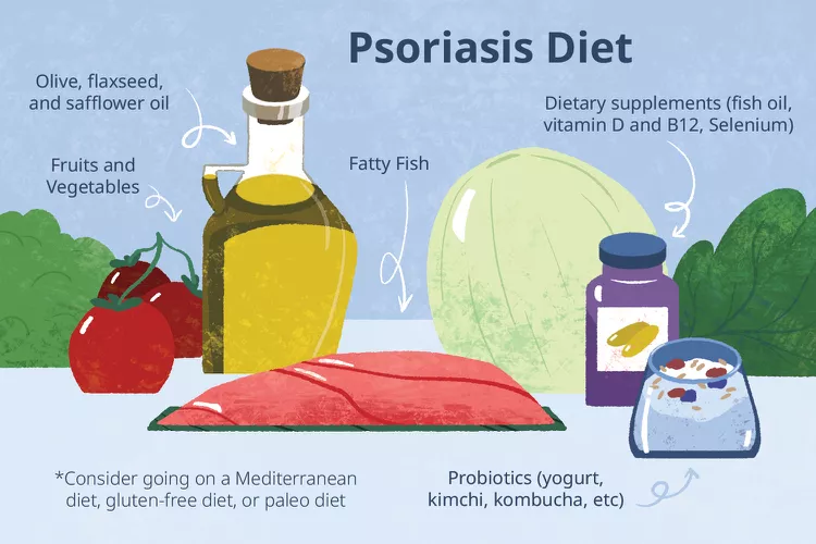 適合銀屑病患者吃的5種食物,你知道幾種? 適合銀屑病患者吃的5種食物,你知道幾種?