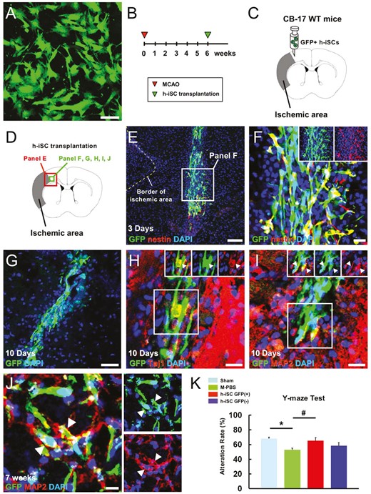 移植的h-iSC分化為成熟神經元,可能有助于MCAO后神經功能的恢復 移植的h-iSC分化為成熟神經元,可能有助于MCAO后神經功能的恢復