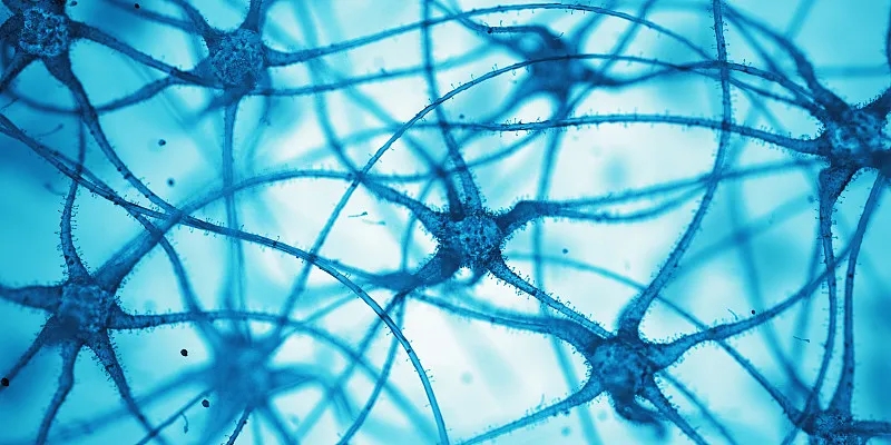 什么是神經(jīng)細(xì)胞?為什么它們很重要? 什么是神經(jīng)細(xì)胞?為什么它們很重要?