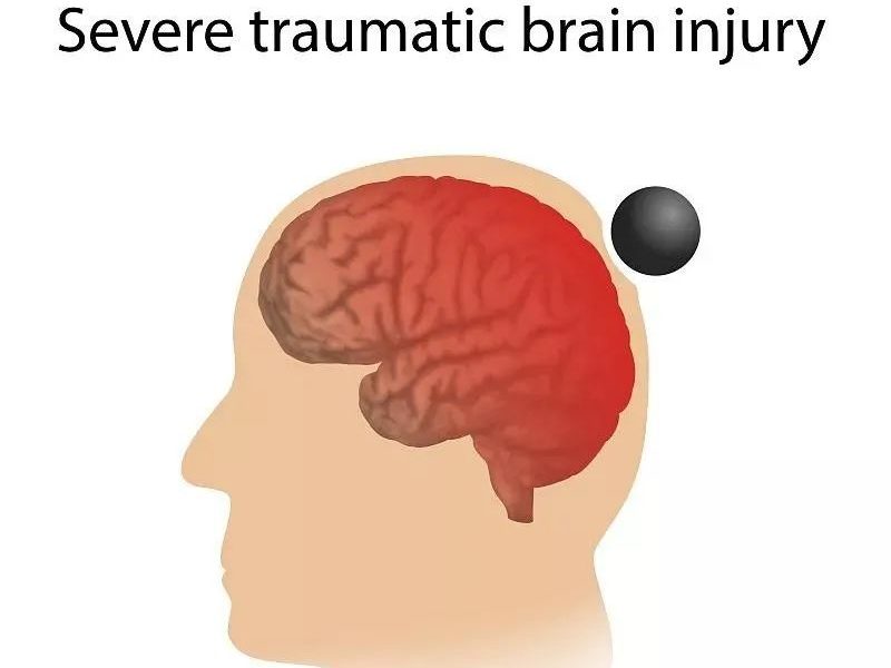 干細胞移植為缺血性腦損傷的治愈提供無限可能 干細胞移植為缺血性腦損傷的治愈提供無限可能