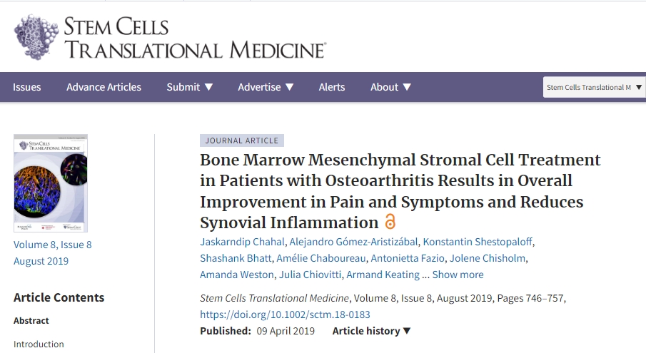 干細胞治療骨關節炎患者可全面改善疼痛和癥狀并減少滑膜炎癥 干細胞治療骨關節炎患者可全面改善疼痛和癥狀并減少滑膜炎癥