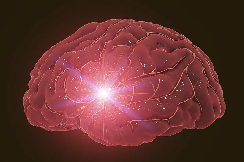 神經(jīng)干細(xì)胞移植治療缺血性卒中的作用 神經(jīng)干細(xì)胞移植治療缺血性卒中的作用