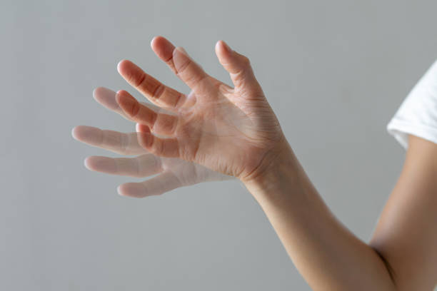 患者接受胚胎干細(xì)胞治療帕金森病的可行性研究 患者接受胚胎干細(xì)胞治療帕金森病的可行性研究