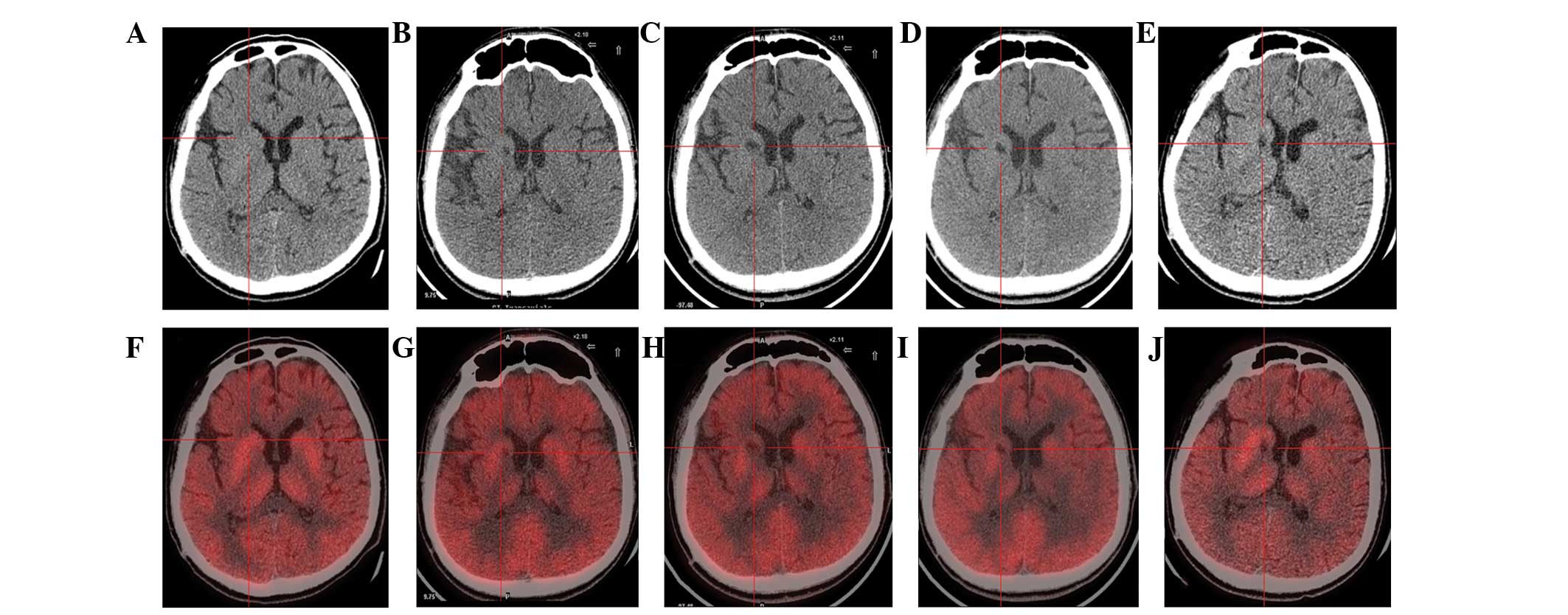 圖1：計算機斷層掃描 (CT) 和正電子發射斷層掃描 (PET) 掃描。