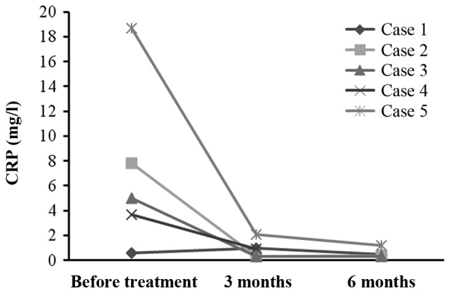 圖4：每位患者治療前后的CRP水平。1名患者的CRP水平降低，而其他4名患者的CRP水平保持穩(wěn)定并在正常范圍內(nèi)。