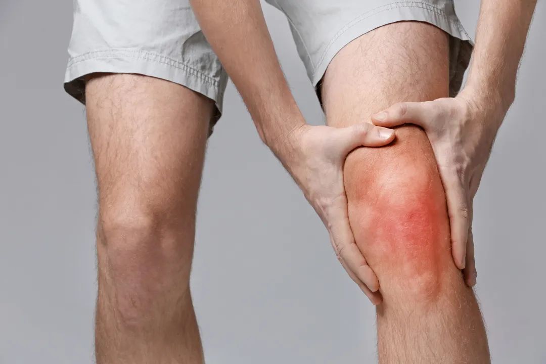 膝骨關節炎 膝骨關節炎