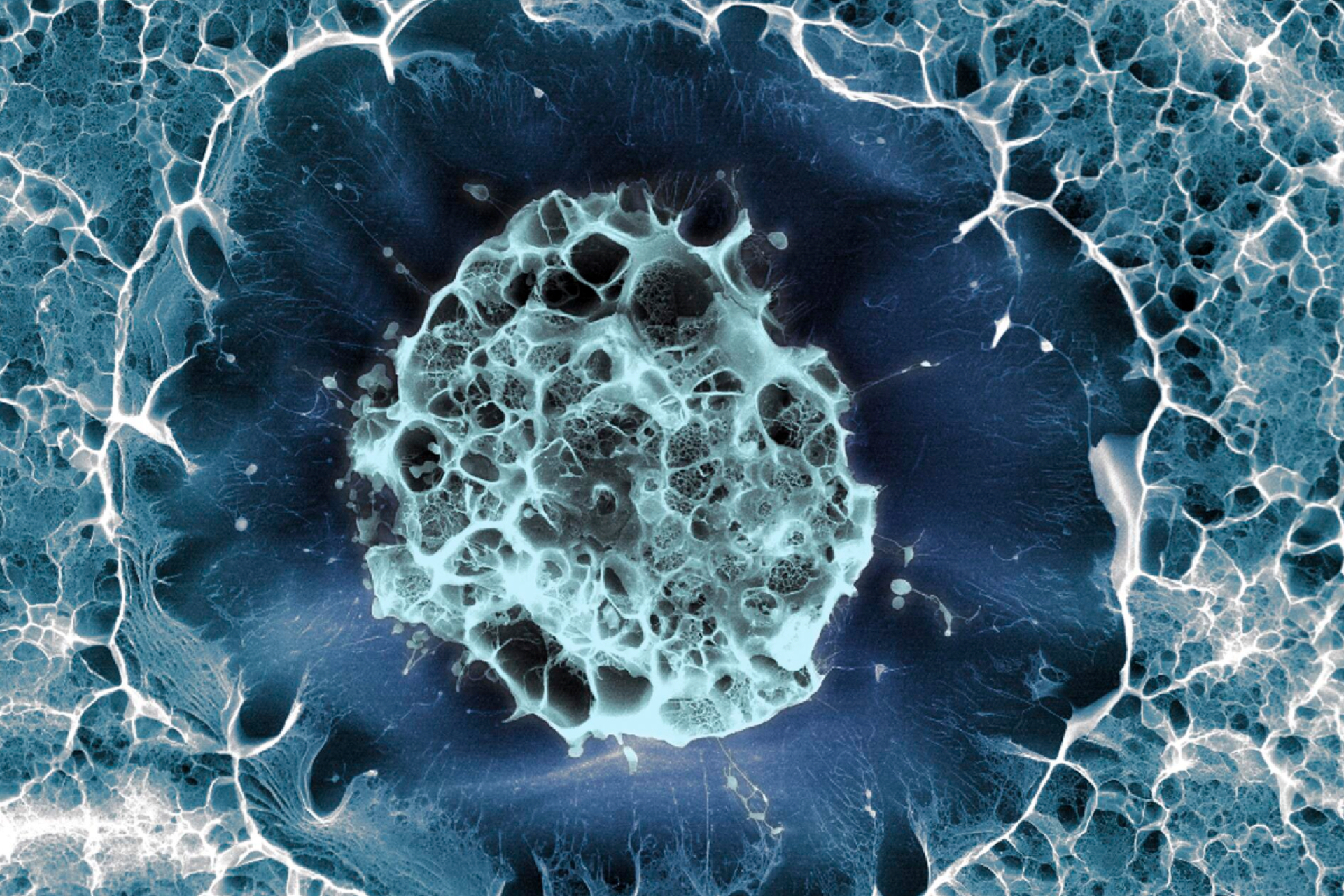 基于人類干細(xì)胞的帕金森病療法被證明是安全的 基于人類干細(xì)胞的帕金森病療法被證明是安全的