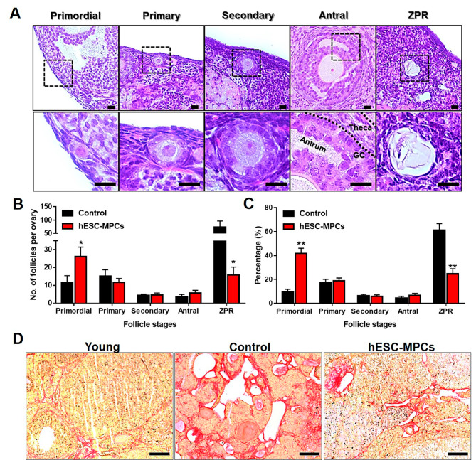 圖3:通過在圍絕經期小鼠中多次引入人胚胎干細胞衍生的 間充質祖細胞(hESC-MPC)來維持卵巢儲備。 圖3:通過在圍絕經期小鼠中多次引入人胚胎干細胞衍生的間充質祖細胞(hESC-MPC)來維持卵巢儲備。