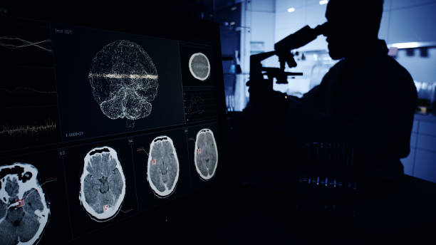 神經系統疾病發病機制復雜，涉及基因突變、衰老過程等多種因素。
