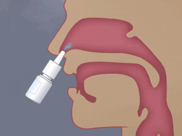 日本居家干細胞噴鼻能治療腦梗死:是科學突破還是商業(yè)噱頭? 日本居家干細胞噴鼻能治療腦梗死:是科學突破還是商業(yè)噱頭?