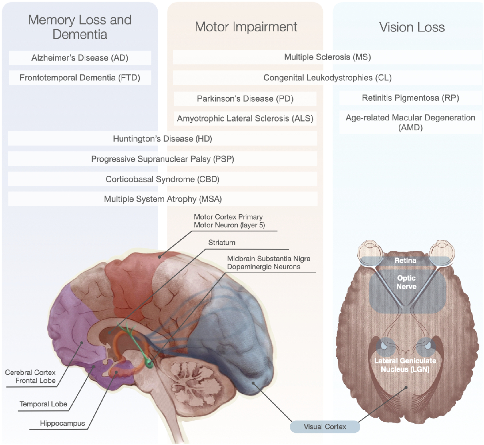 圖1:神經退行性疾病和受影響的大腦區域的主要功能影響。 圖1:神經退行性疾病和受影響的大腦區域的主要功能影響。