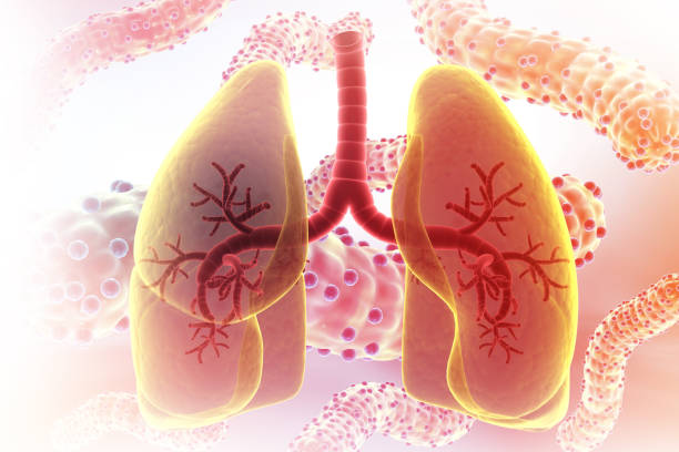 獲得國家藥監局批準!廣州醫科大學附屬第一醫院正在開展人臍帶源間充質干細胞注射液治療IPF臨床研究 獲得國家藥監局批準!廣州醫科大學附屬第一醫院正在開展人臍帶源間充質干細胞注射液治療IPF臨床研究