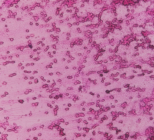 人羊膜上皮細胞對中樞神經系統損傷和疾病的治療潛力 人羊膜上皮細胞對中樞神經系統損傷和疾病的治療潛力