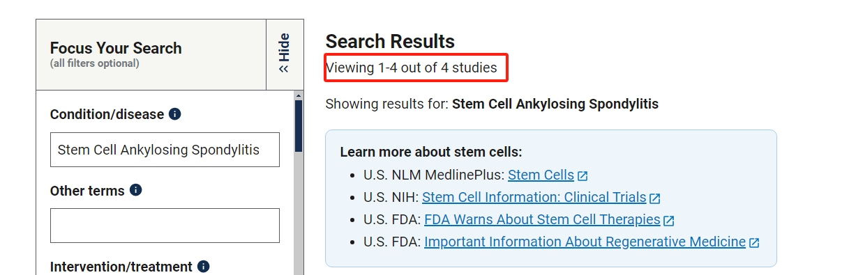 clinicaltrials.gov網(wǎng)站上注冊的有關(guān)干細(xì)胞治療強(qiáng)直性脊柱炎的臨床研究項(xiàng)目有4項(xiàng)。其中已完成的有1項(xiàng)。 clinicaltrials.gov網(wǎng)站上注冊的有關(guān)干細(xì)胞治療強(qiáng)直性脊柱炎的臨床研究項(xiàng)目有4項(xiàng)。其中已完成的有1項(xiàng)。