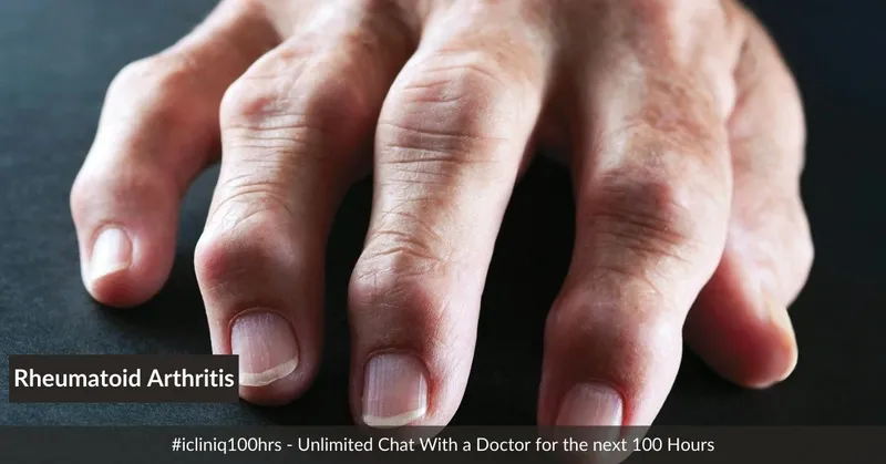 類風(fēng)濕關(guān)節(jié)炎的體征和癥狀是什么?及其治療方法 類風(fēng)濕關(guān)節(jié)炎的體征和癥狀是什么?及其治療方法