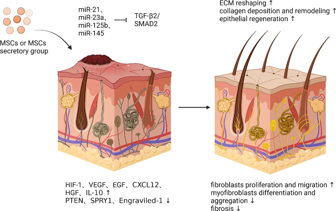 圖6:間充質干細胞促進皮膚疤痕修復的機制。 圖6:間充質干細胞促進皮膚疤痕修復的機制。