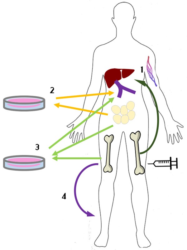 圖1：間充質(zhì)干細(xì)胞治療1型糖尿病方法示意圖。
