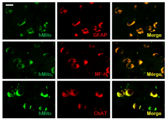干細胞移植到小鼠腦組織后分化成神經元和星細胞 干細胞移植到小鼠腦組織后分化成神經元和星細胞